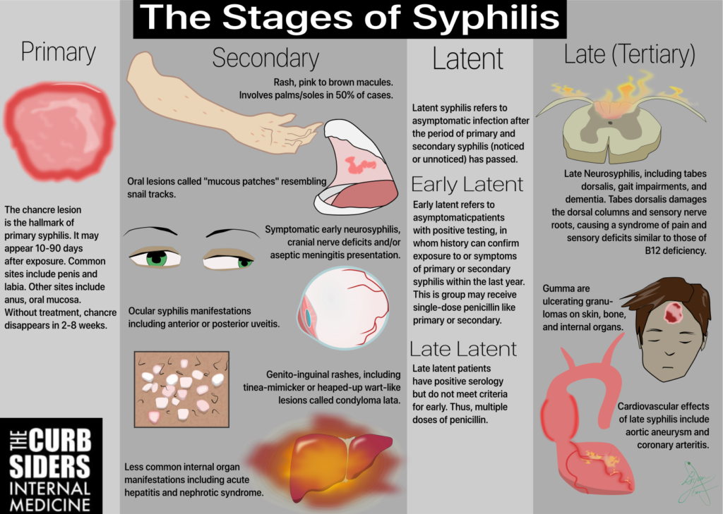#127 STIs Syphilis, Gonorrhea and Chlamydia