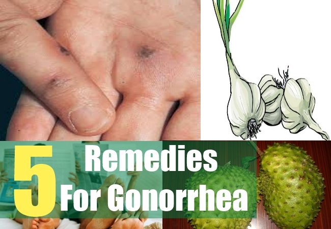 5 Home Remedies For Gonorrhea