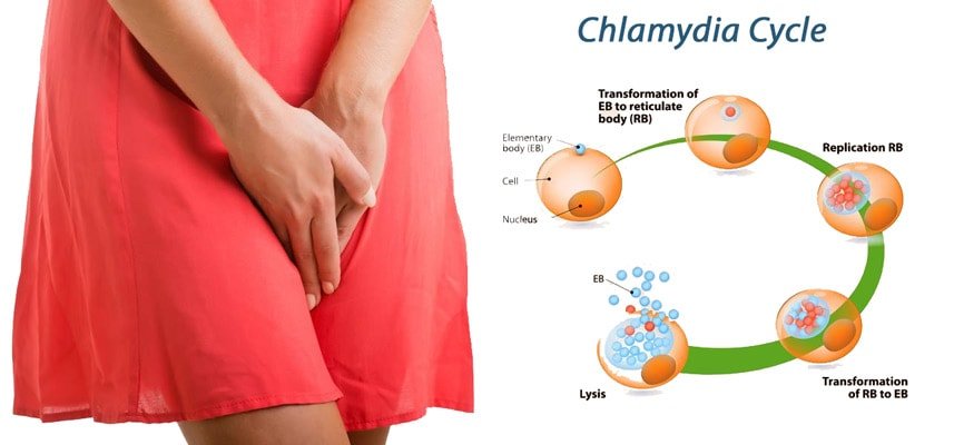 9 Effective Home Remedies for Chlamydia in Men &  Women