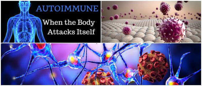 Autoimmune Diseases: Definition, Causes, How Does it ...