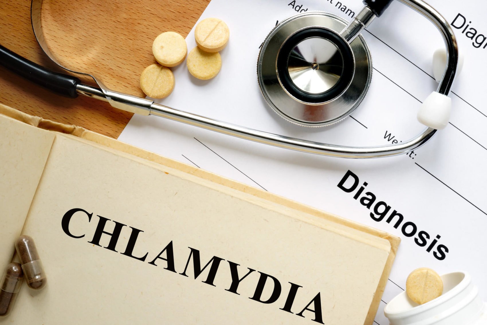Can CBD Oil Help to Cure Chlamydia?