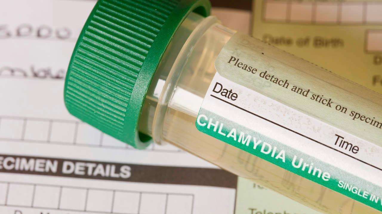 Can Diabetes Cause Chlamydia