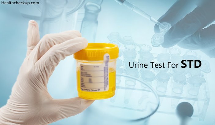 Can Urine Test Detect STD