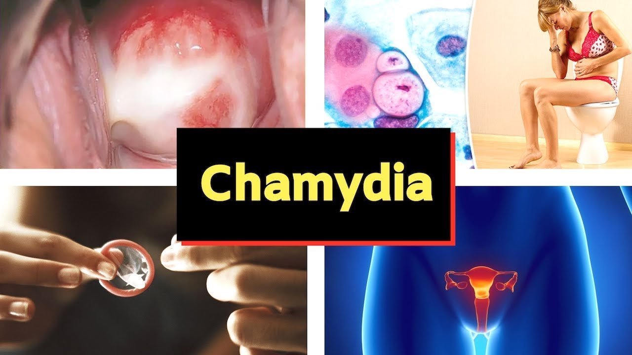 Chlamydia pictures