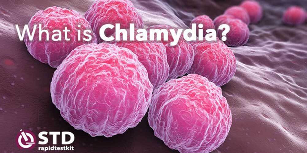 Chlamydia signs and symptoms