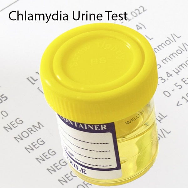 Chlamydia Urine Test