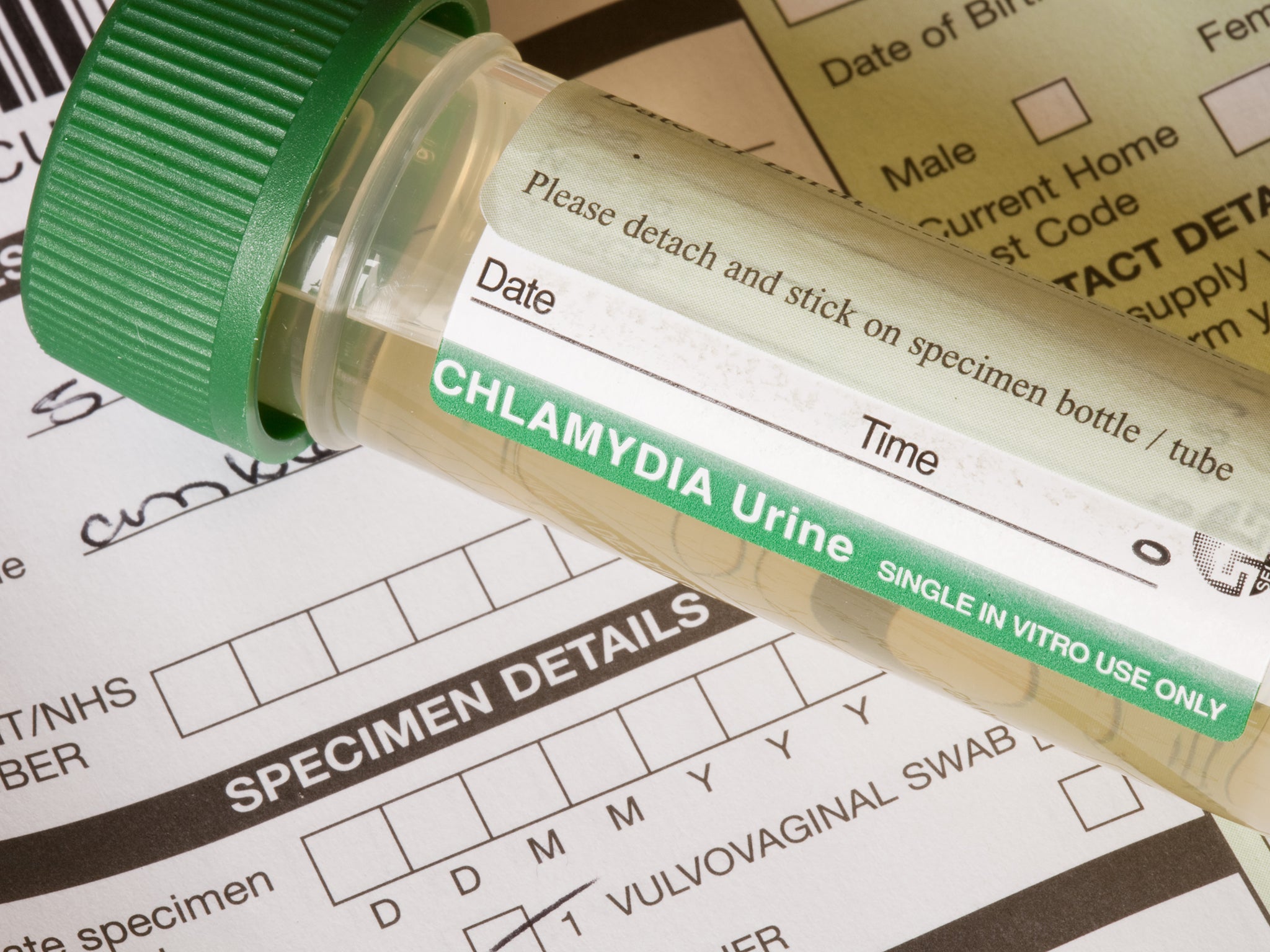Chlamydia: US researchers claim to have developed vaccine against the ...