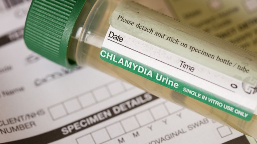 Chlamydia vaccine 