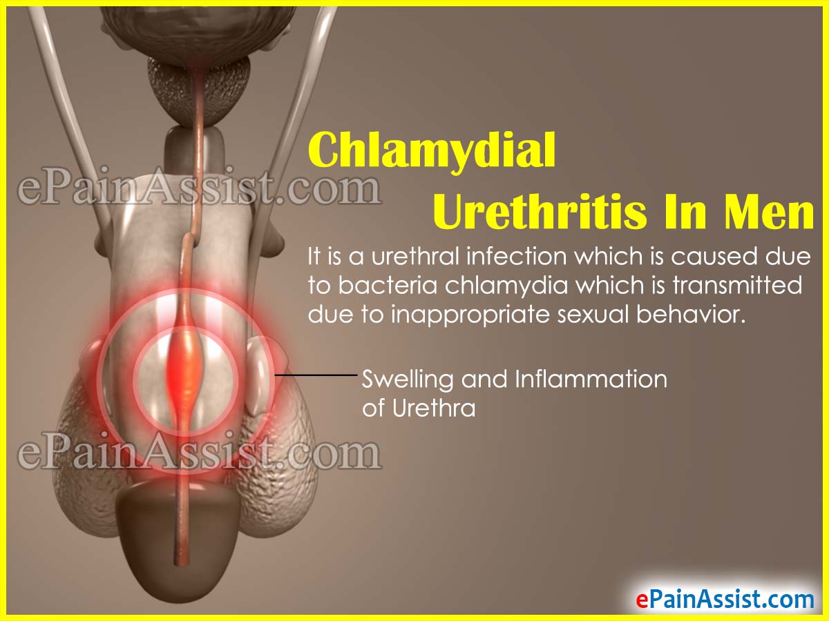 Chlamydial Urethritis In Men