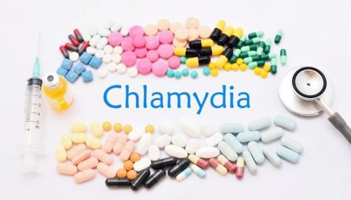 Everything you need to know about chlamydia â Positively ...