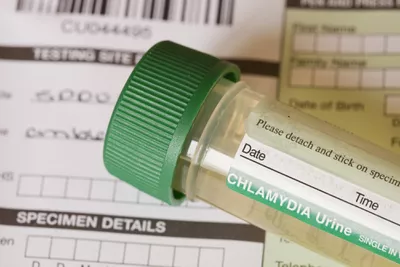 Fewer Women Are Getting Tested for ChlamydiaHere