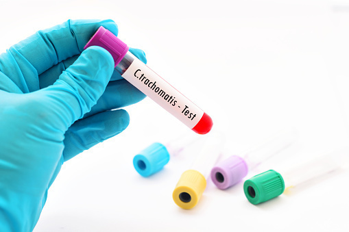 Free Chlamydia Testing
