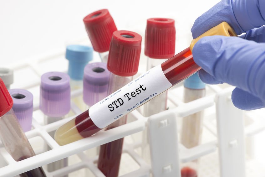 Get Tested for STDs Today: What to do When Tested Positive ...