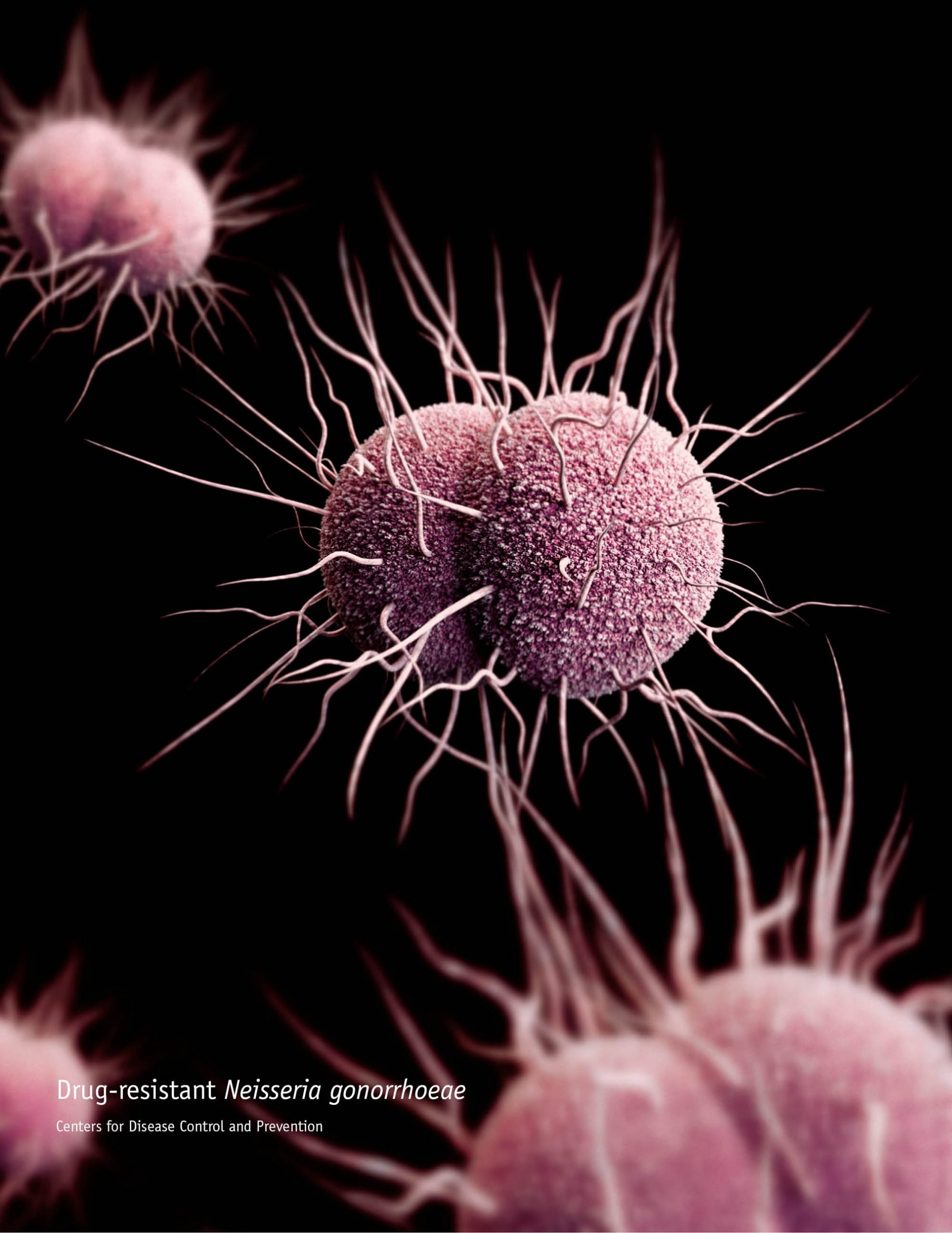 Gonorrhea resistance to AZM reaches 5% threshold among ...