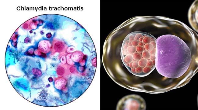 Habitat and Morphology of Chlamydia trachomatis