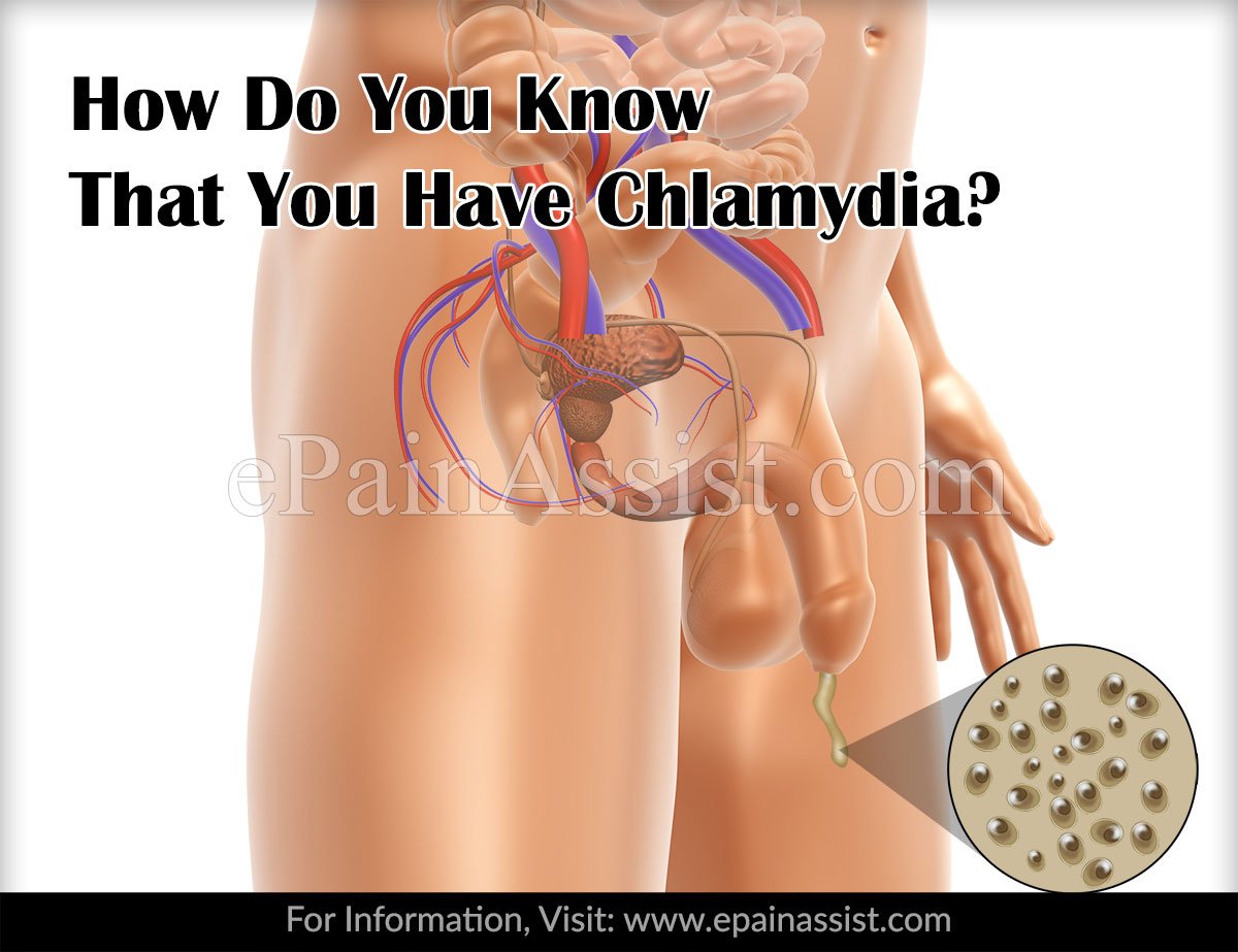 How can chlamydia go away â Health News
