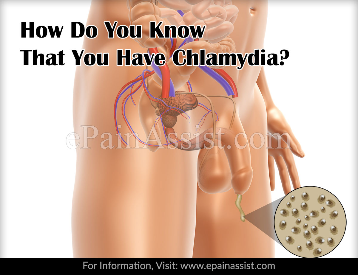 How can chlamydia go away  Health News