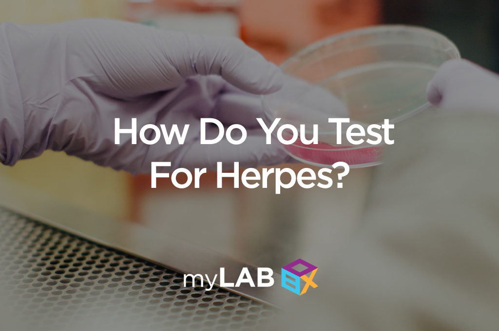 How Do You Test For Herpes?