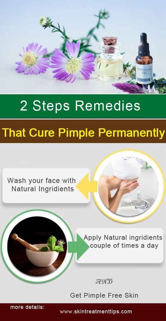 How to Get Rid of Pimples Permanently Using Home Remedies ...