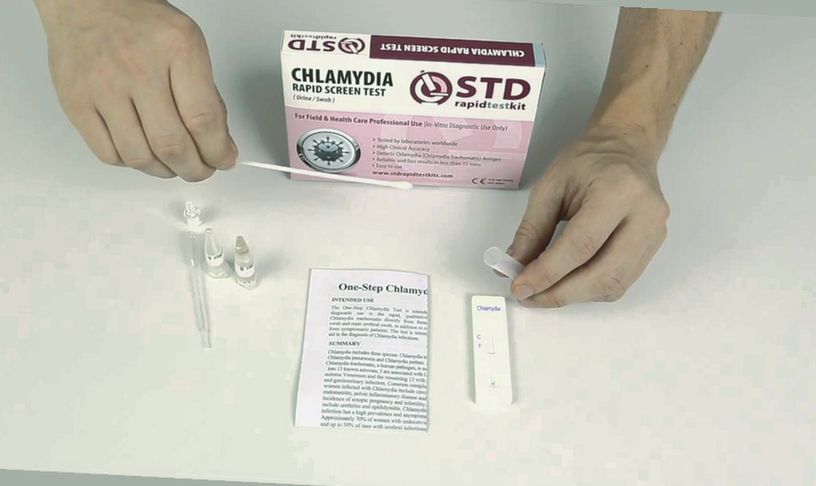 STD Screening: The Basics