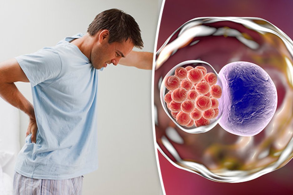 Symptoms of Chlamydia in males: Six warning signs of the STI you should ...