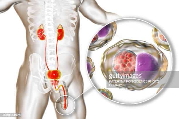 Top Urinary Tract Infection Stock Illustrations, Clip art, Cartoons ...