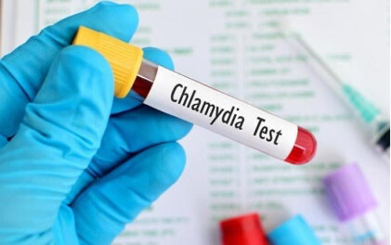 Understanding Chlamydia: Symptoms and Treatment ...