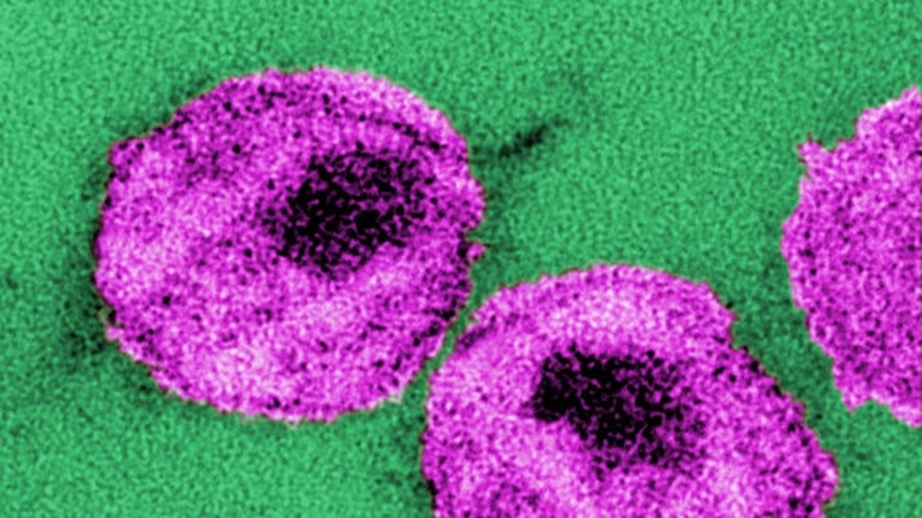US sexually transmitted disease epidemic worsening, CDC says