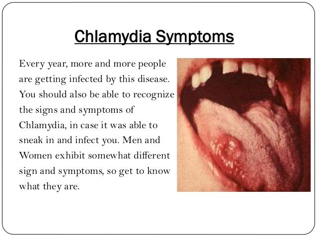 What Does Chlamydia Do To You