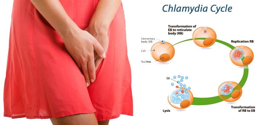 What is Chlamydia, Causes, Symptoms, Prevention and ...