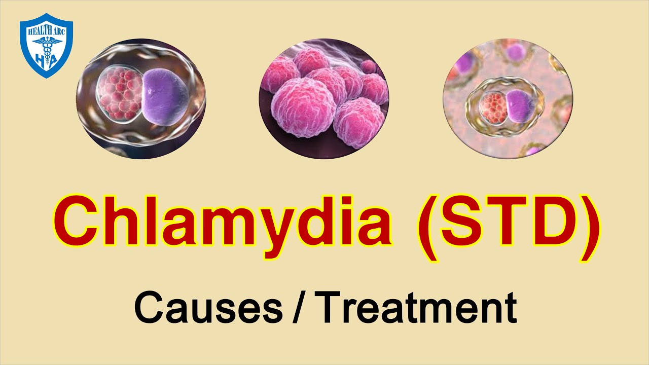 What Is Chlamydia?