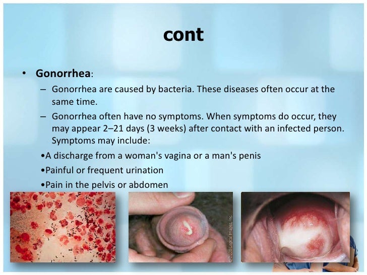 What is complementary treatment, treatment of syphilis and gonorrhea ...
