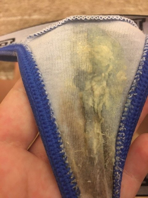 yeast infection of bv? PLEASE HELP
